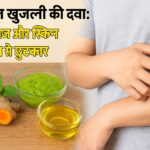 दाद खाज खुजली की दवा